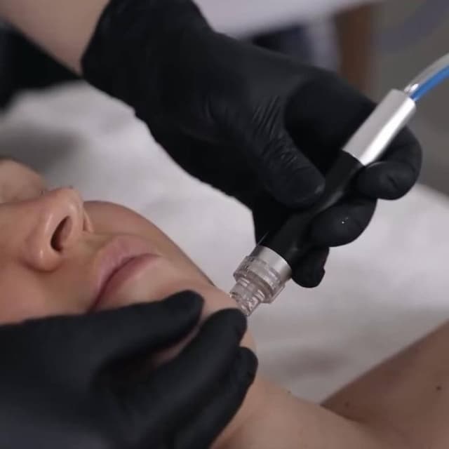 Hydrafacials 6-Boost Package at Beauty Lab by Irina in Plano, TX